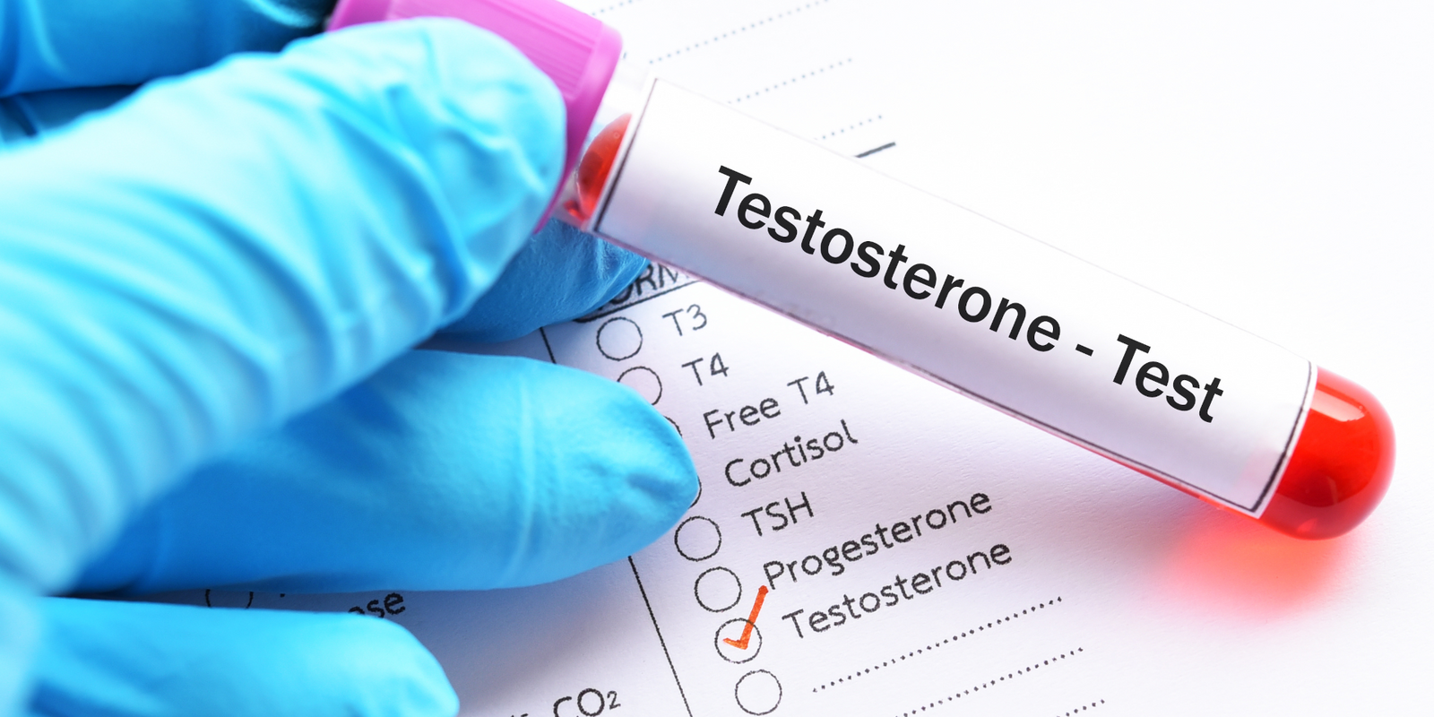 What To Look For In a Testosterone Booster